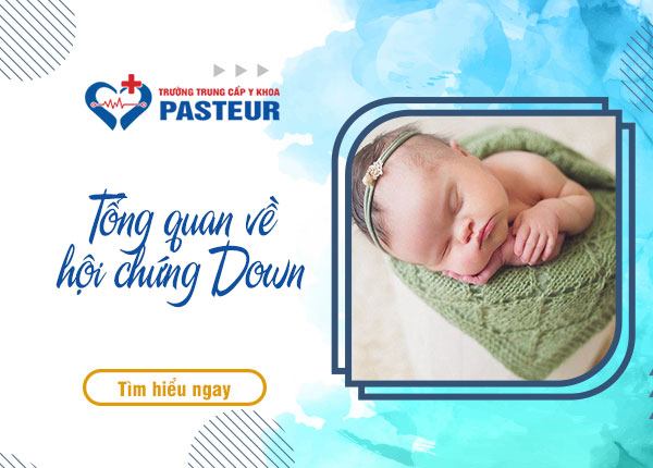 Tổng quan về hội chứng Down