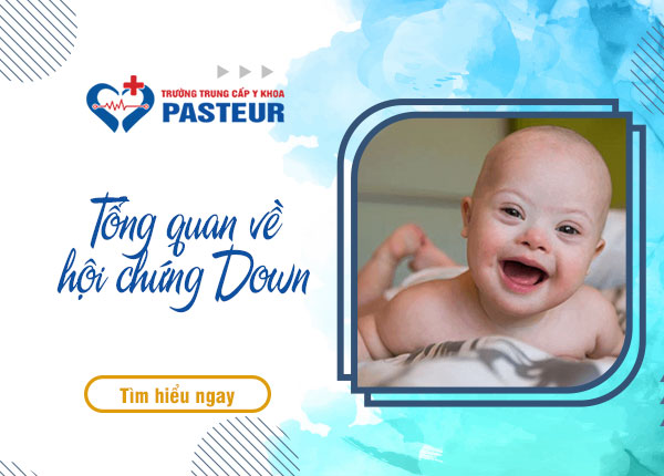 Tổng quan về hội chứng Down